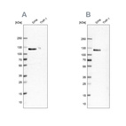 Anti-UBA1 Antibody
