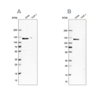 Anti-UBA1 Antibody