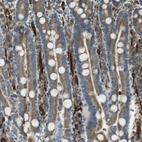 Immunohistochemical staining of human duodenum shows moderate membranous-cytoplasmic positivity in glandular cells.