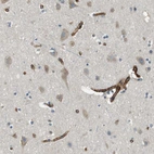 Immunohistochemical staining of human cerebral cortex shows strong membranous-cytoplasmic positivity in endothelial cells.