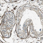 Immunohistochemical staining of human testis shows strong membranous-cytoplasmic positivity in peritubular myoid cells.