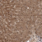 Immunohistochemical staining of human liver shows moderate cytoplasmic-nucleus positivity in hepatocytes.