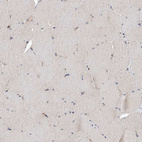 Immunohistochemical staining of human skeletal muscle shows no positivity in myocytes.