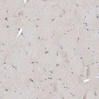 Immunohistochemical staining of human skeletal muscle shows no positivity in myocytes.