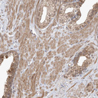 Immunohistochemical staining of human prostate shows moderate cytoplasmic positivity in smooth muscle cells.