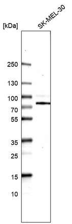 Western blot analysis in human cell line SK-MEL-30.