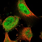Immunofluorescent staining of human cell line U-251 MG shows localization to nucleoplasm & cytosol.