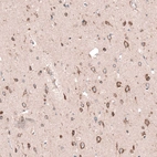 Immunohistochemical staining of human cerebral cortex shows strong cytoplasmic positivity in glial cells and neurons.