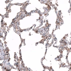 Immunohistochemical staining of human lung shows moderate cytoplasmic positivity in macrophages and alveolar cells.