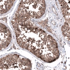 Immunohistochemical staining of human testis shows strong cytoplasmic positivity in cells in tubules.