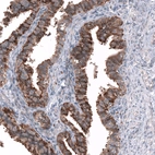 Immunohistochemical staining of human fallopian tube shows strong cytoplasmic positivity in glandular cells.