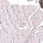 Immunohistochemical staining of human skeletal muscle shows no positivity in myocytes as expected.