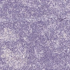 Immunohistochemical staining of human lymph node shows no positivity in non-germinal center cells as expected.