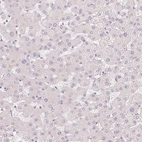 Immunohistochemical staining of human liver shows no positivity in hepatocytes as expected.