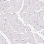Immunohistochemical staining of human skeletal muscle shows no positivity in myocytes as expected.