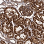 Immunohistochemical staining of human kidney shows strong cytoplasmic granular positivity in cells in tubules and strong cytoplasmic membranous positivity in cells in glomeruli.