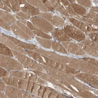 Immunohistochemical staining of human skeletal muscle shows moderate cytoplasmic granular positivity in myocytes.