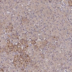 Immunohistochemical staining of human pancreas shows moderate nucleoli/cytoplasmic positivity in exocrine glandular cells.
