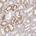 Immunohistochemical staining of human kidney shows moderate nucleoli/cytoplasmic positivity in cells in tubules.