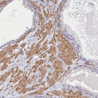 Immunohistochemical staining of human prostate shows moderate cytoplasmic positivity in smooth muscle cells.