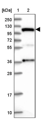 Lane 1: Marker [kDa] 250, 130, 95, 72, 55, 36, 28, 17, 10_br/_Lane 2: Human cell line RT-4
