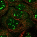 Immunofluorescent staining of human cell line A-431 shows localization to nucleoli.