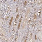 Immunohistochemical staining of human kidney shows strong positivity in plasma in cells in tubules.
