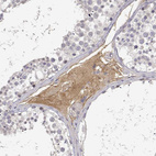 Immunohistochemical staining of human testis shows strong cytoplasmic positivity in Leydig cells.
