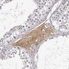 Immunohistochemical staining of human testis shows strong cytoplasmic positivity in Leydig cells.