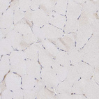 Immunohistochemical staining of human skeletal muscle shows no cytoplasmic positivity in myocytes as expected.