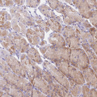 Immunohistochemical staining of human stomach shows moderate cytoplasmic positivity in glandular cells.