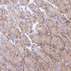 Immunohistochemical staining of human stomach shows moderate cytoplasmic positivity in glandular cells.
