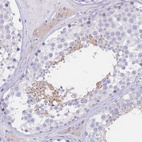 Immunohistochemical staining of human testis shows moderate cytoplasmic positivity in cells in seminiferous ducts and weak cytoplasmic positivity in Leydig cells.