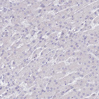 Immunohistochemical staining of human liver shows no positivity in hepatocytes as expected.