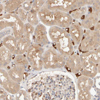 Immunohistochemical staining of human kidney shows moderate cytoplasmic positivity in cells in tubules.