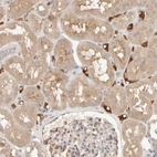 Immunohistochemical staining of human kidney shows moderate cytoplasmic positivity in cells in tubules.