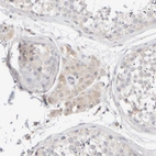 Immunohistochemical staining of human testis shows moderate cytoplasmic positivity in Leydig cells.