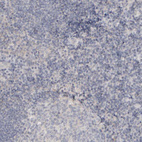 Immunohistochemical staining of human tonsil shows no cytoplasmic positivity in non-germinal center cells as expected.