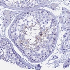 Immunohistochemical staining of human testis shows weak cytoplasmic positivity in spermatids.