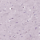 Immunohistochemical staining of human cerebral cortex shows weak nucleus positivity in glial cells.