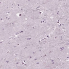 Immunohistochemical staining of human cerebral cortex shows weak nucleus positivity in glial cells.