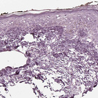 Immunohistochemical staining of human skin shows no positivity in squamous epithelial cells as expected.