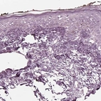 Immunohistochemical staining of human skin shows no positivity in squamous epithelial cells as expected.