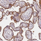 Immunohistochemical staining of human placenta shows strong cytoplasmic granular positivity in trophoblastic cells.