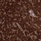 Immunohistochemical staining of human pancreas shows strong cytoplasmic positivity in exocrine glandular cells.
