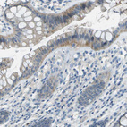 Immunohistochemical staining of human colon shows moderate cytoplasmic positivity in glandular cells.