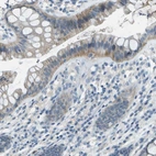 Immunohistochemical staining of human colon shows moderate cytoplasmic positivity in glandular cells.