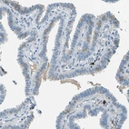 Immunohistochemical staining of human fallopian tube shows moderate cytoplasmic positivity in ciliated cells.