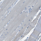 Immunohistochemical staining of human skeletal muscle shows no positivity in myocytes as expected.
