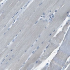 Immunohistochemical staining of human skeletal muscle shows no positivity in myocytes as expected.